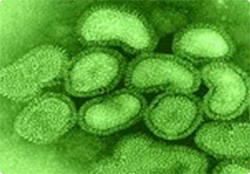 人から人に感染する新型の豚インフルエンザに子ども3人が感染（アメリカ）