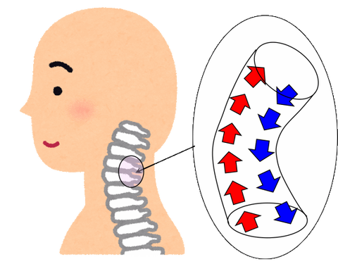 normalneck
