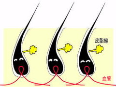 goodhair2