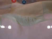 P2150462