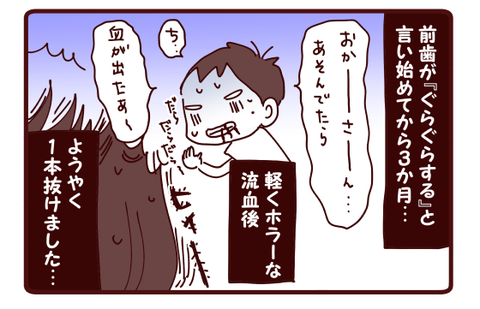 同じ歯抜けなのに1
