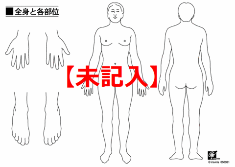 身体図未記入