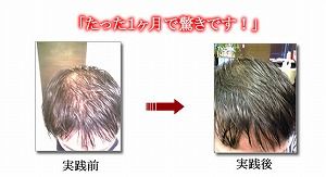 育毛小林04