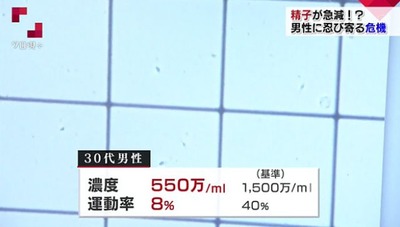 WS000057