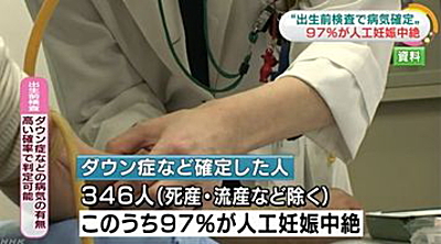 まあそうするための検査だからねぇ