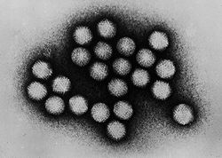 250px-Adenovirus_transmission_electron_micrograph_B82-0142_lores