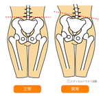 骨盤不、良
