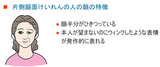 片側顔面痙攣