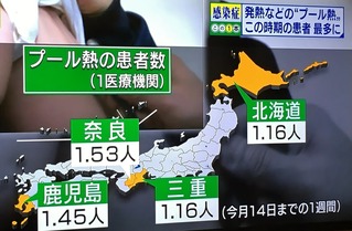 プール熱
