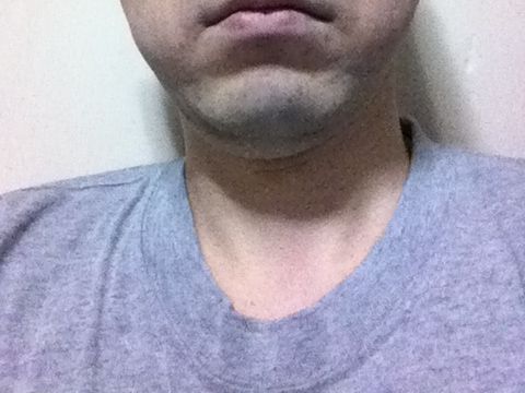 neck1