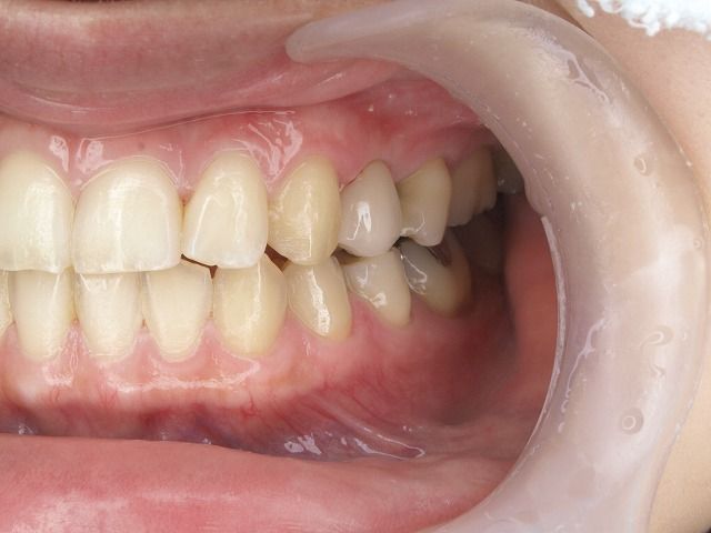 PB092763
