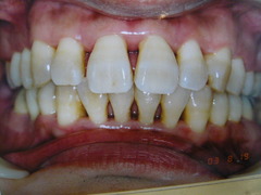 P1150011