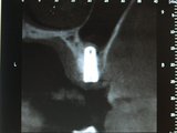 P3081386