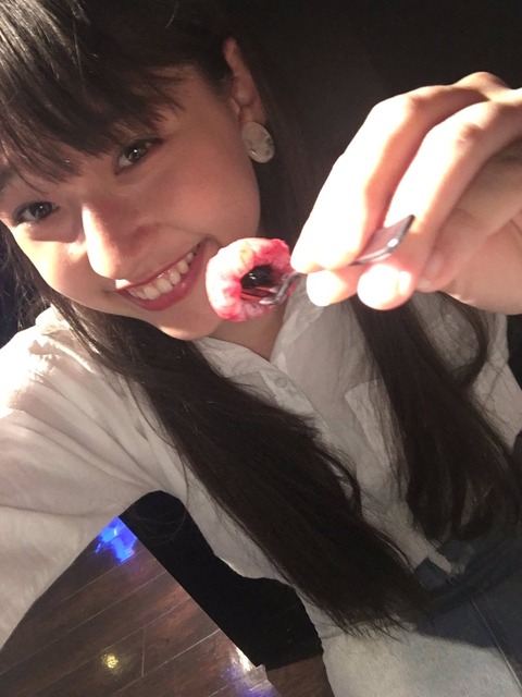 NVp