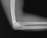 elbow-joint-20170912