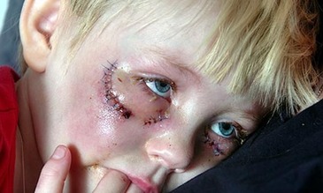Swedish child beated by Muslims