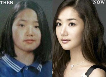 Korean Park Min Young Plastic Surgery