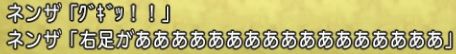 捻挫