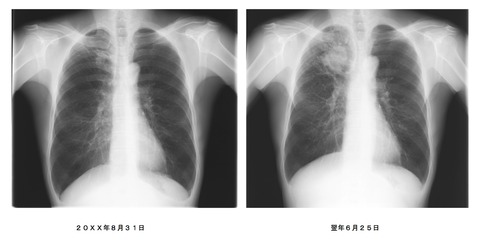 胸写1