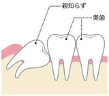 親知らず