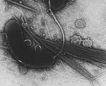210px-Vibrio_cholerae