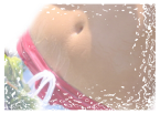 腸閉塞 症状