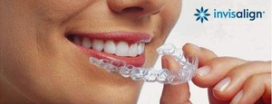 invisalign