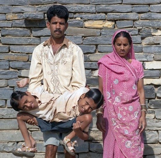 インドの結合双生児は4本の腕と2本の足でたくましく生きている5