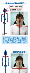 バイタルリアクトセラピー