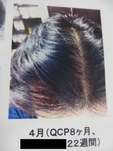 CIMG5880