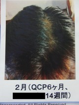 CIMG4296