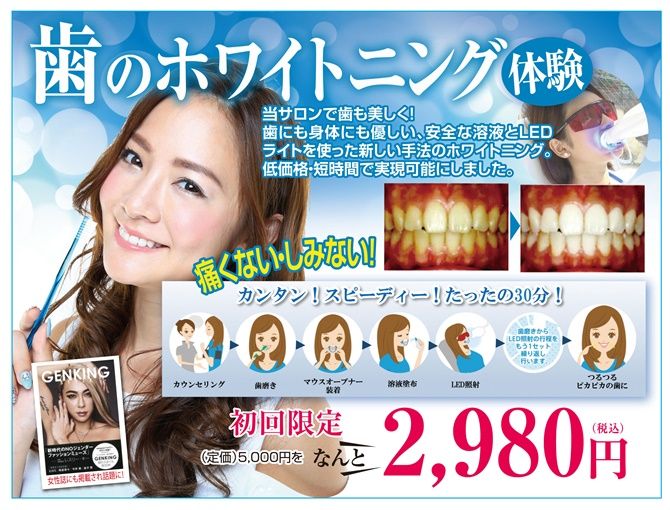 white5-670