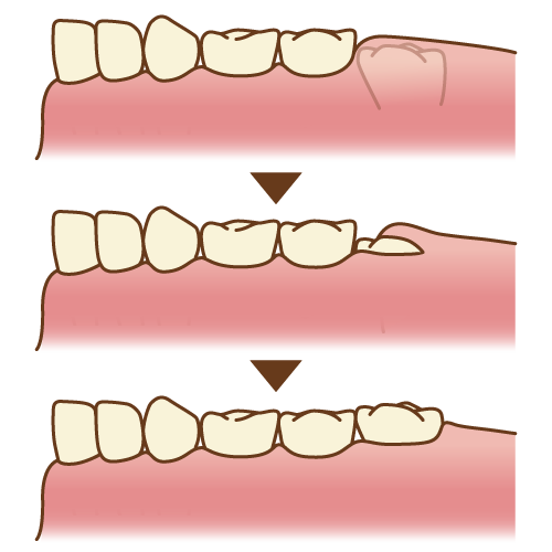 molar_6yo10