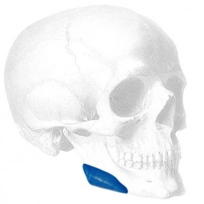 vertical-mandibular-angle-implant