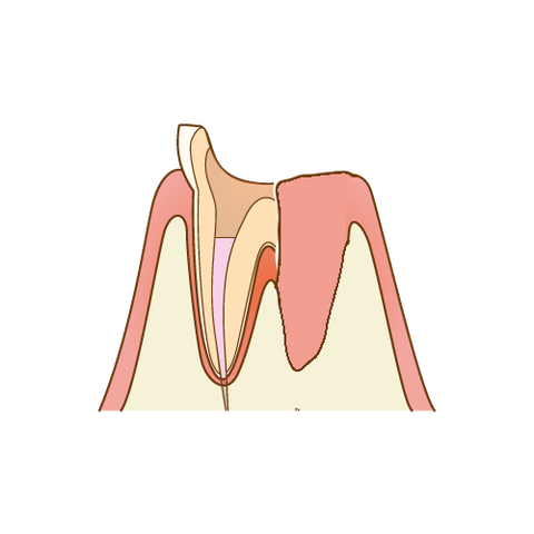 は11