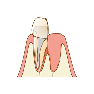 ha3
