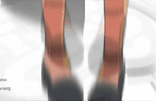 首の折れるナオ