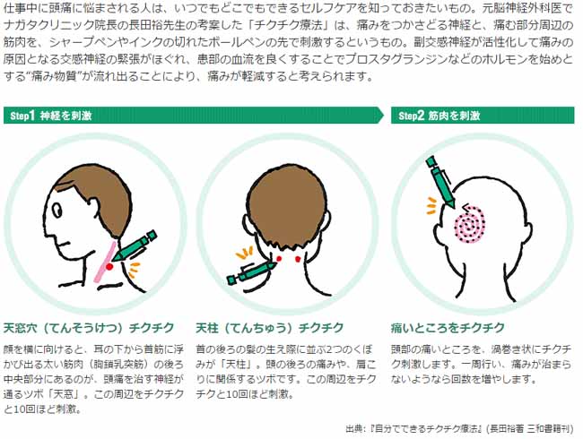 ハゲてるw