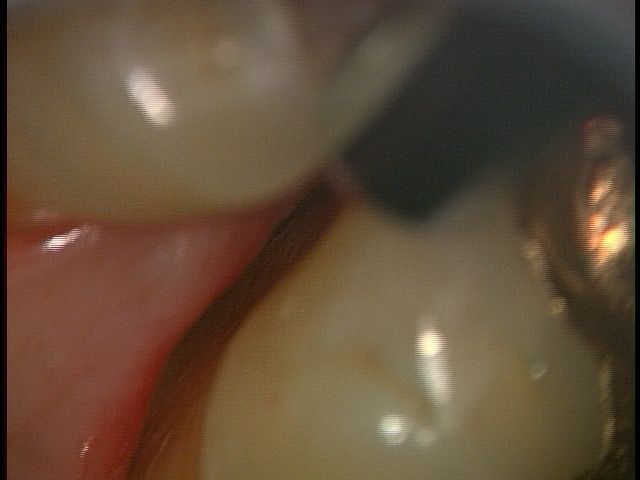 20160826_142344722145 (1)