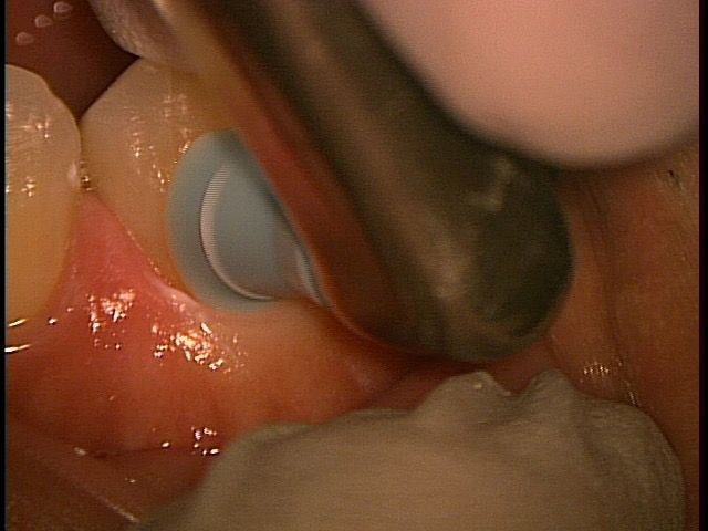 20150417_101527057461