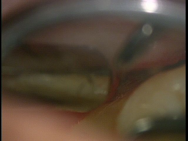 20160826_141544544800 (1)