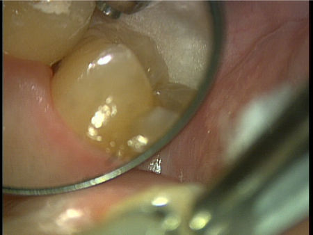 pre ortho7