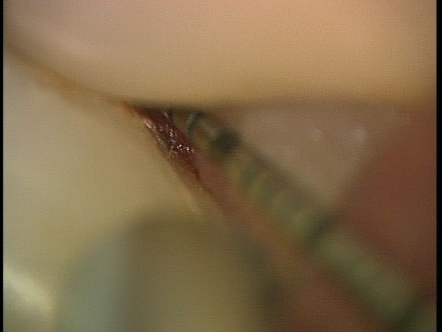 20151219