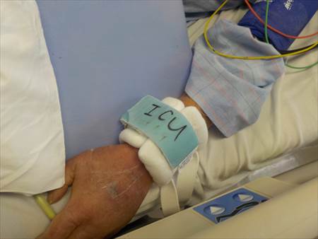 父左手むくみ１２３_R