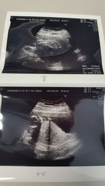 16w2