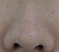 20181104-1