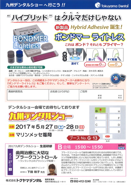 ボンドマーライトレス