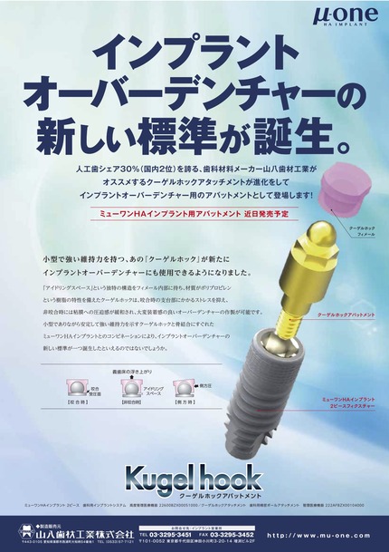 クーゲルホック