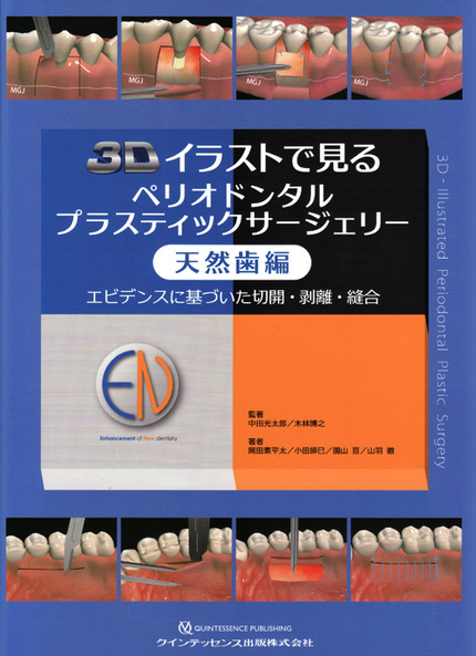 3D¥¤¥é¥¹¥È¤Ç¸«¤ë¥Ú¥ê¥ª¥É¥ó¥¿¥ë