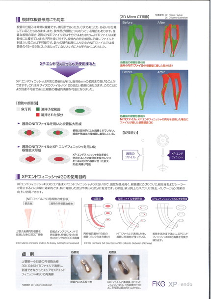 XPエンドフィニッシャ
